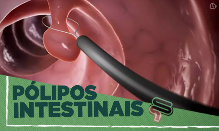 p-lipos-intestinais-gastroclinic